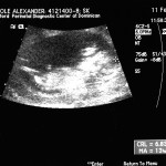 12 week ultrasound 2