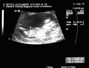12 week ultrasound 2