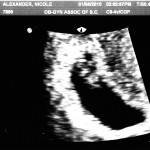 ultrasound at 7 weeks