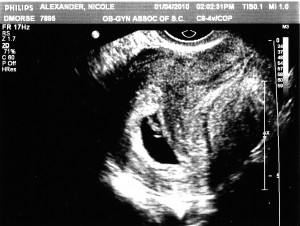 7 week ultrasound 2